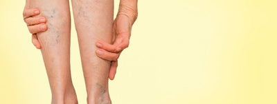 Raskustunne, valu või turse jalgades? Salakaval vaevus, mida ei tohiks ignoreerida